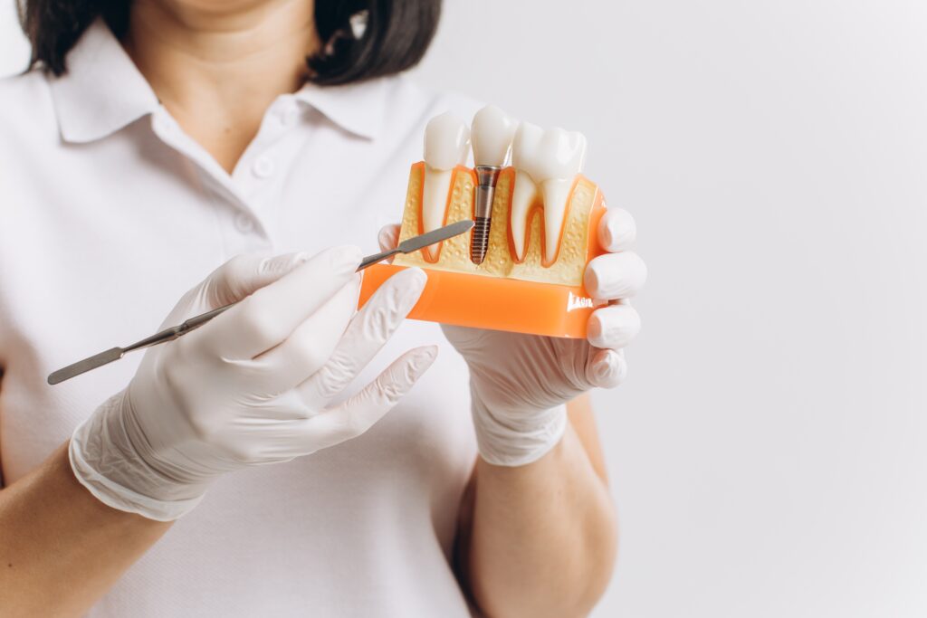 Dental Implants Broomfield